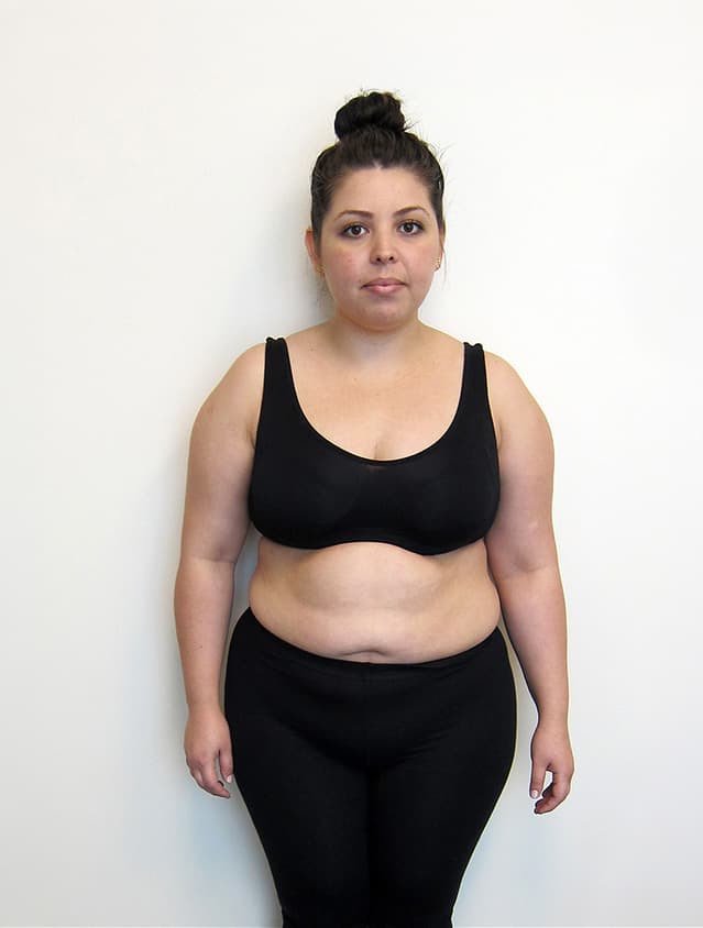 Elvia Rocha, before photo